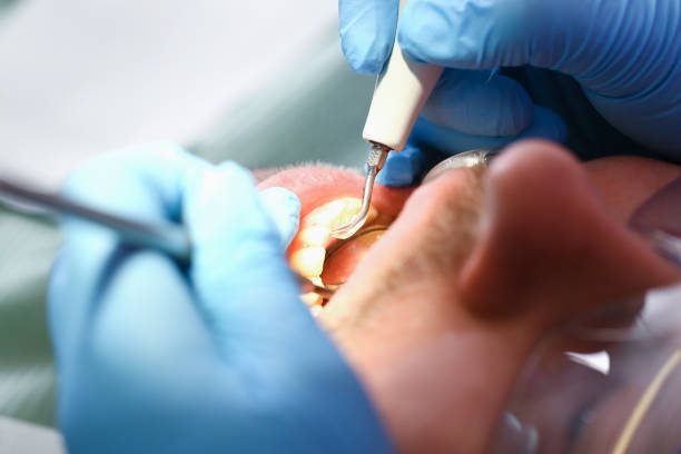 Best Emergency Treatment for Oral Infections in Prichard, AL