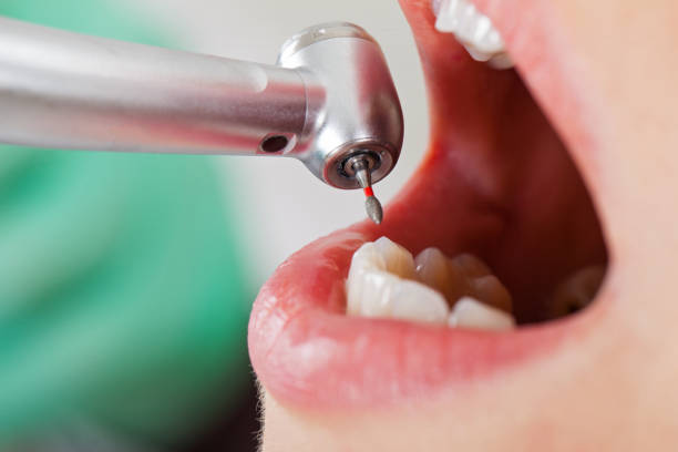 Best Emergency Cosmetic Dentistry (e.g., broken veneers) in Prichard, AL